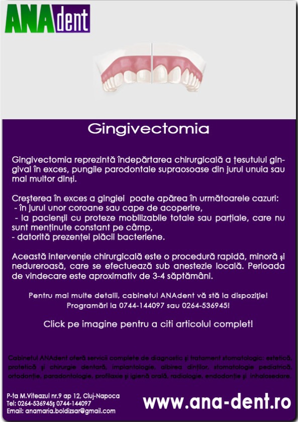Newsletter martie gingivectomia